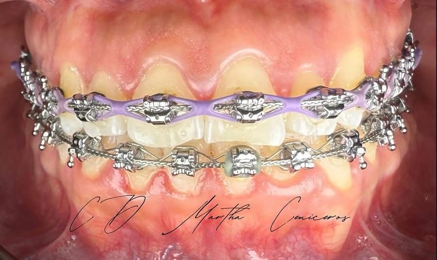 Martha Alicia Ceniceros Betancourt-26