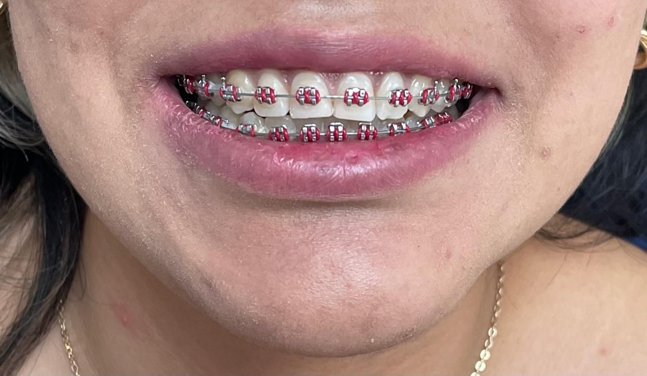 Anuar Becerril Castro-18