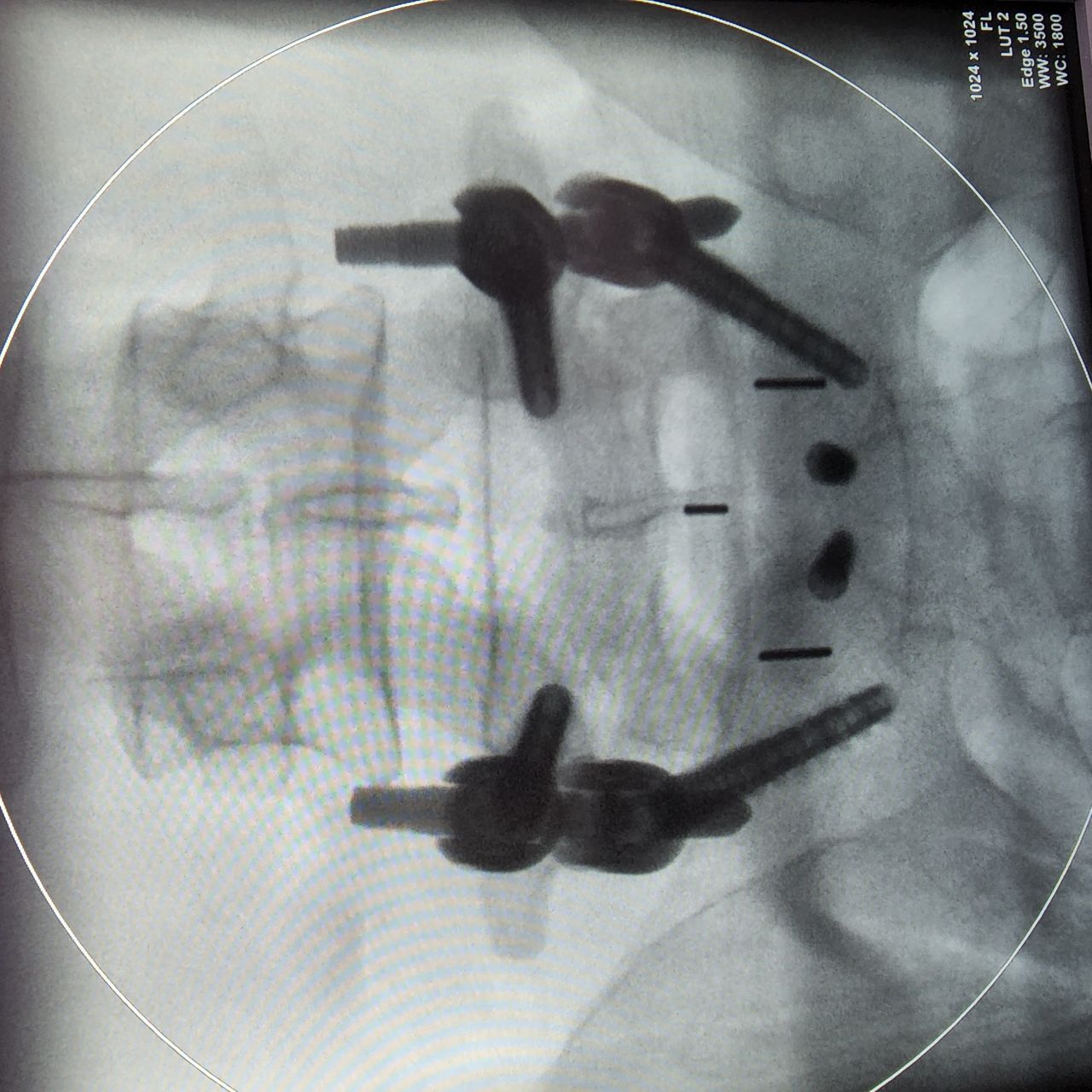 Carlos Francisco Zambrano Osuna-1
