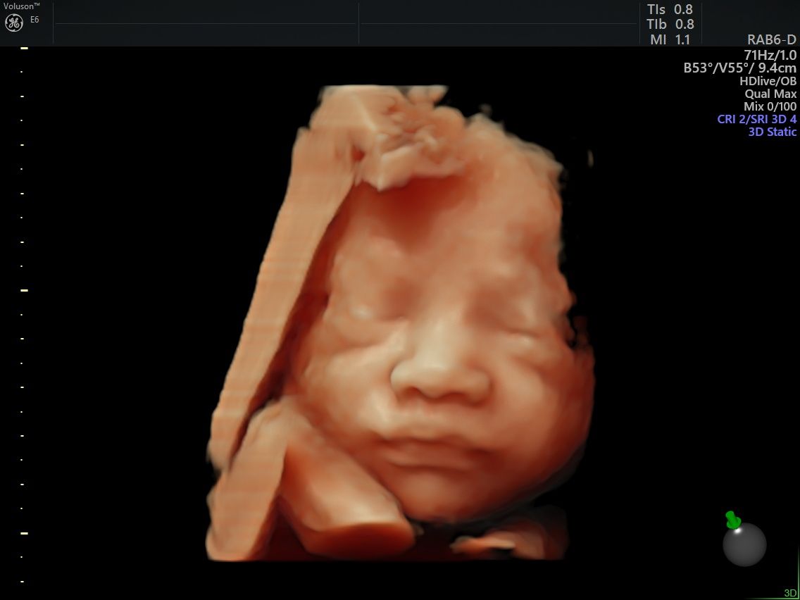 Oscar Alejandro Sánchez Gámez-7