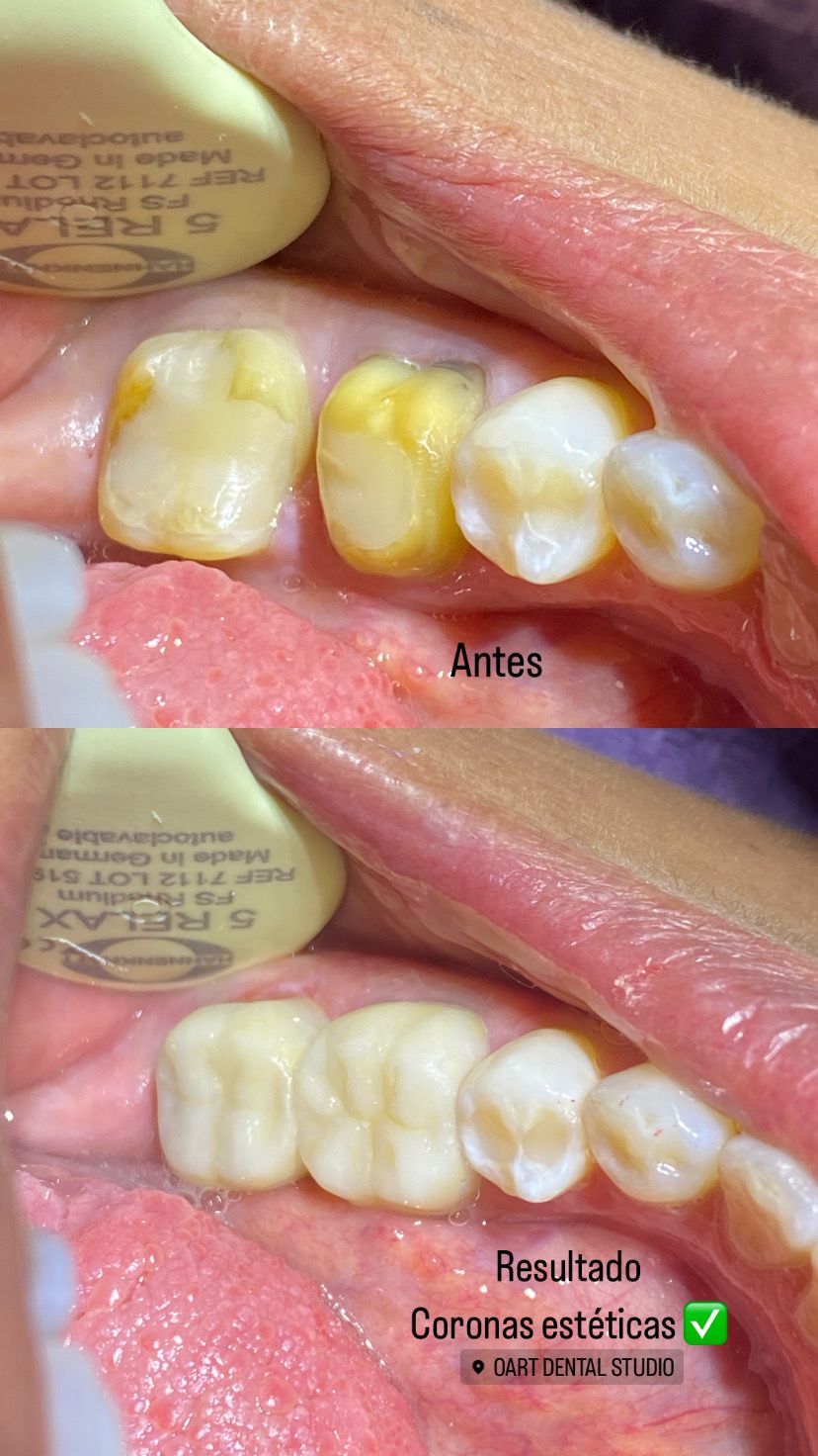 Cinthya Arelí Hernández Ramírez-4