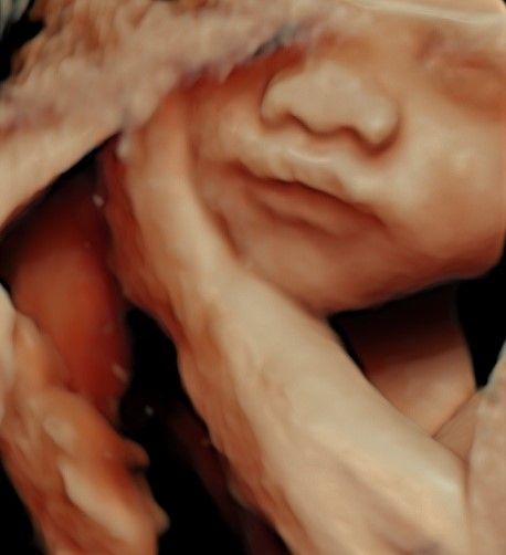 Nallely Moreno  Uribe-9