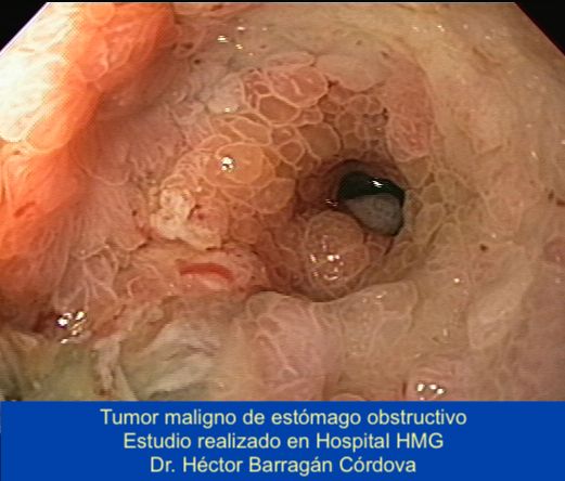 Héctor Hugo Barragán Córdova-2