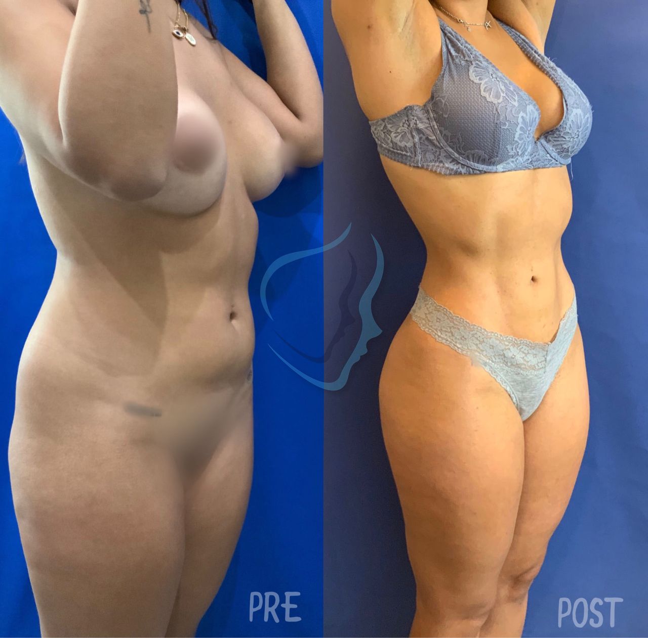 Giuseppe Tanzillo-33