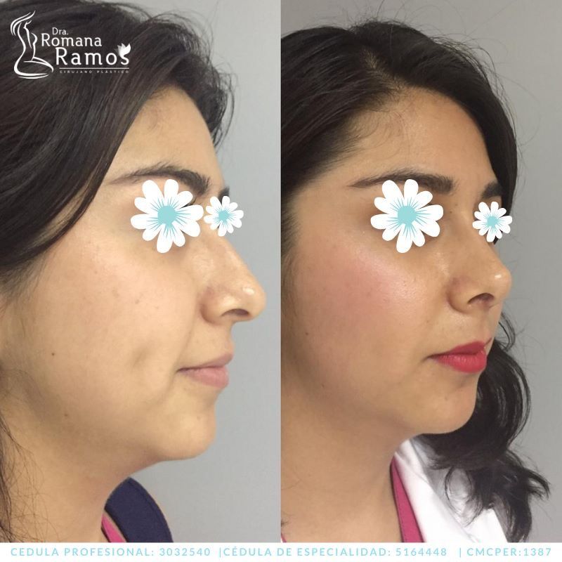 Romana Ramos Cárdenas-41