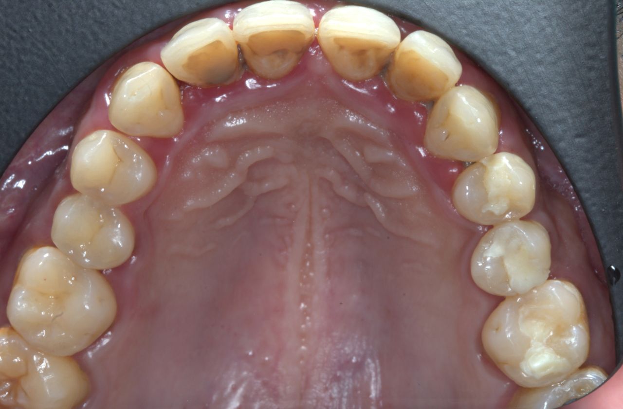 Agustin Salamanca Tapia-28