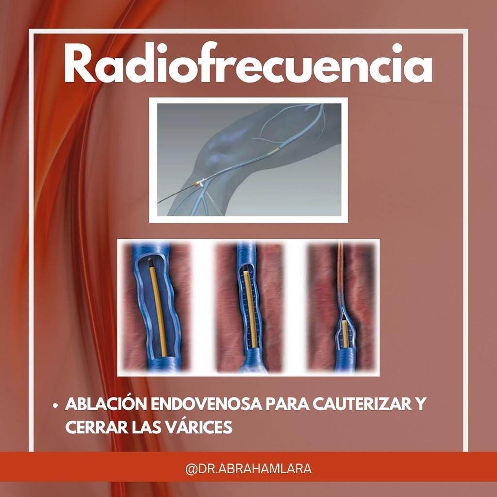 Miguel Abraham Lara Perez-33