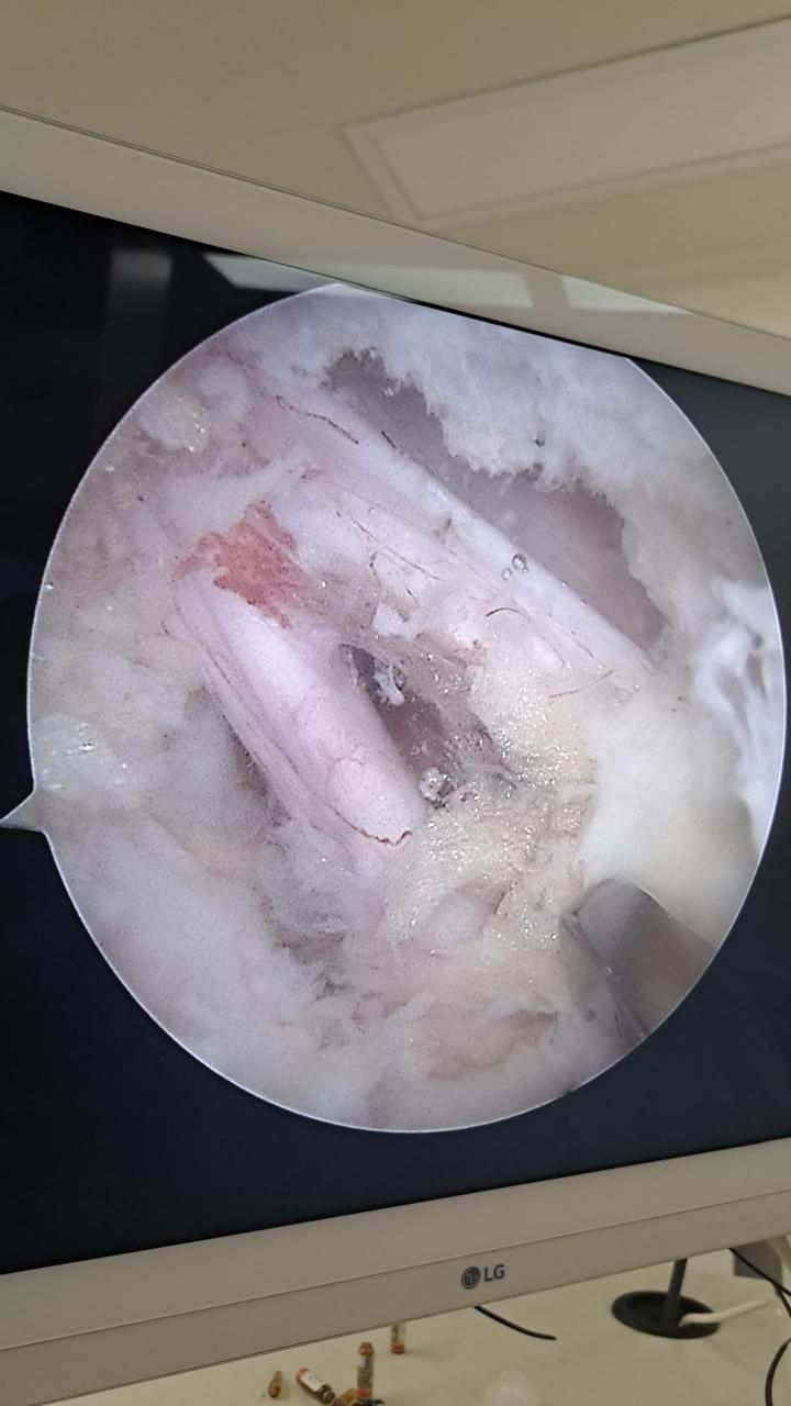 Francisco Prado Mercado-0