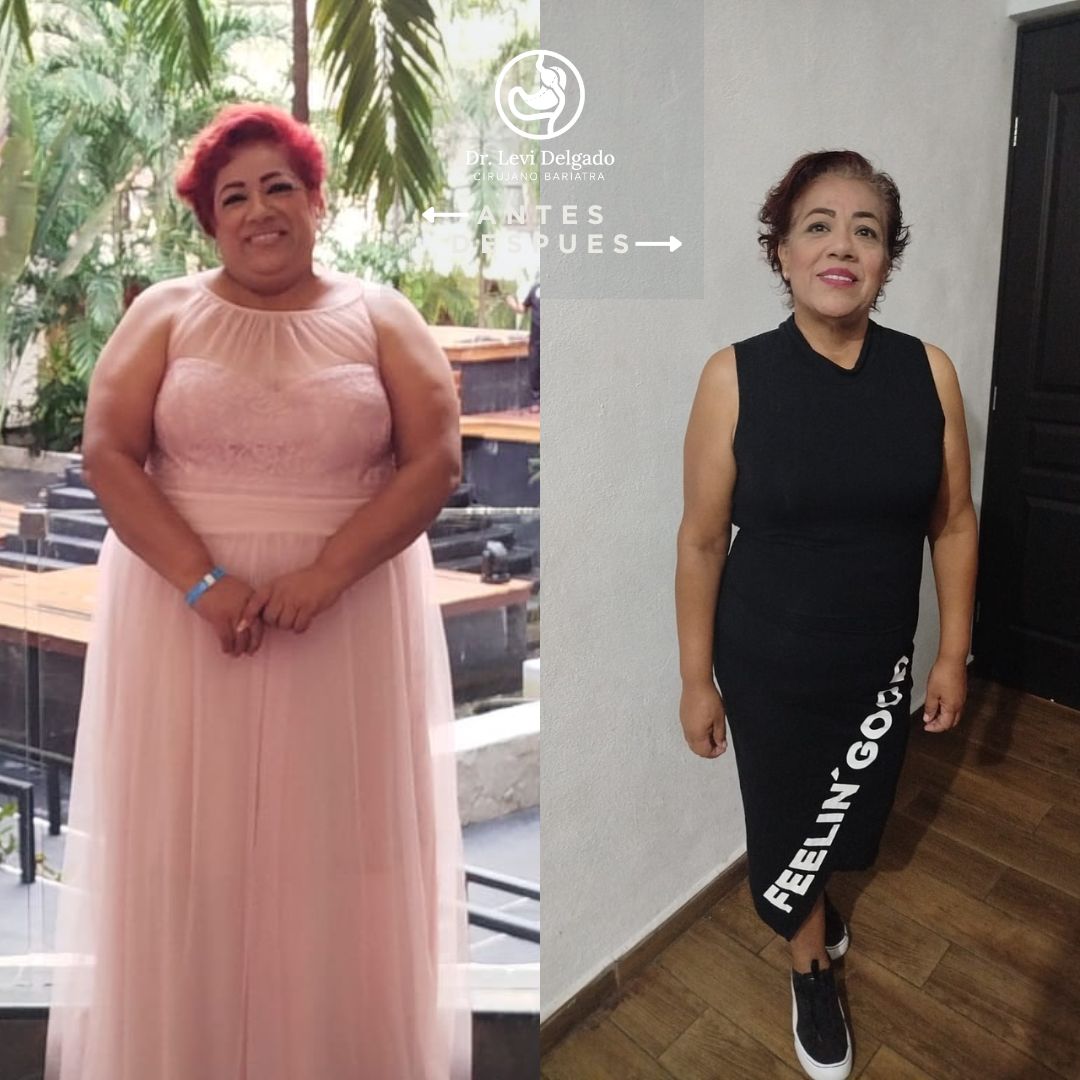 Levi Delgado García-15