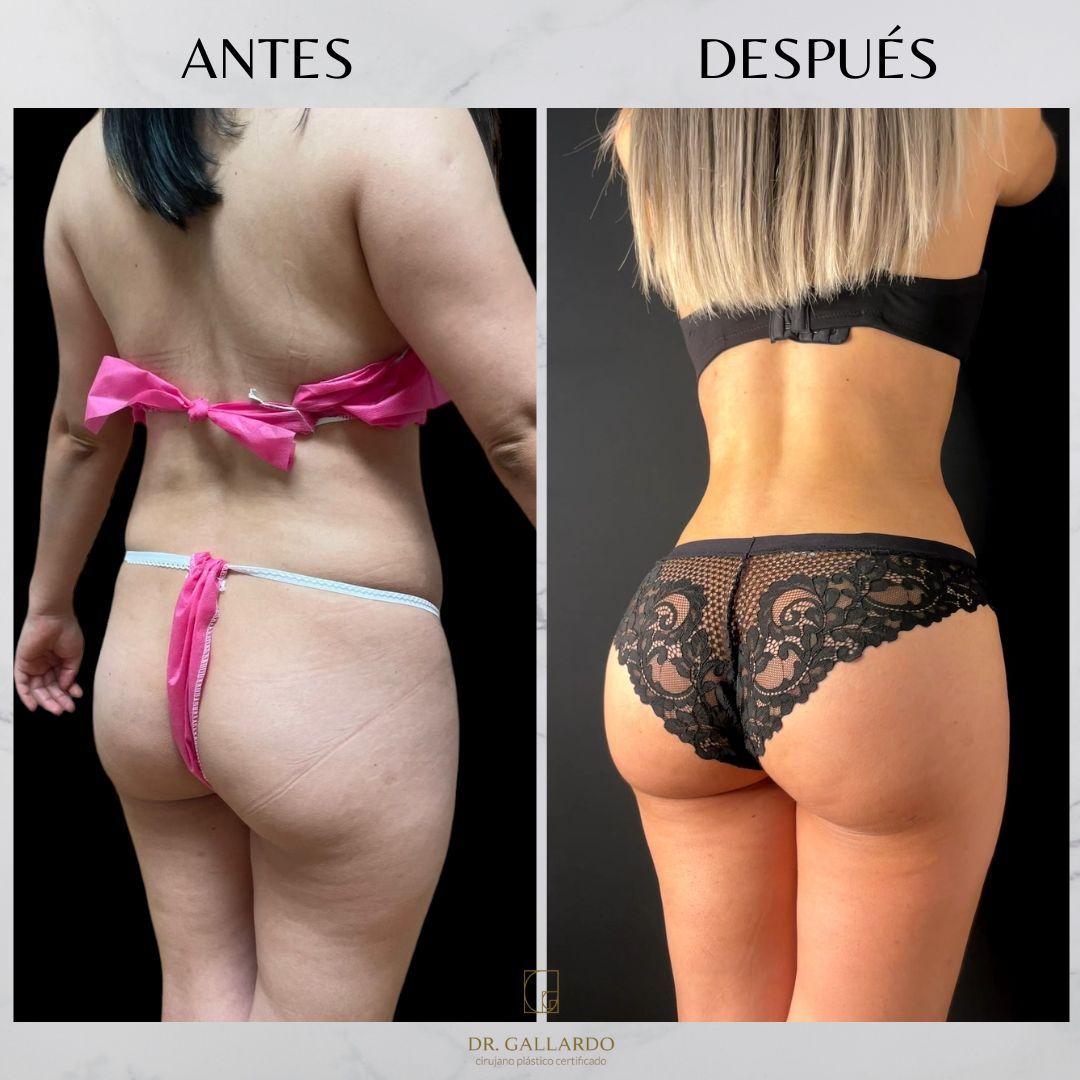 Fernando Gallardo-11