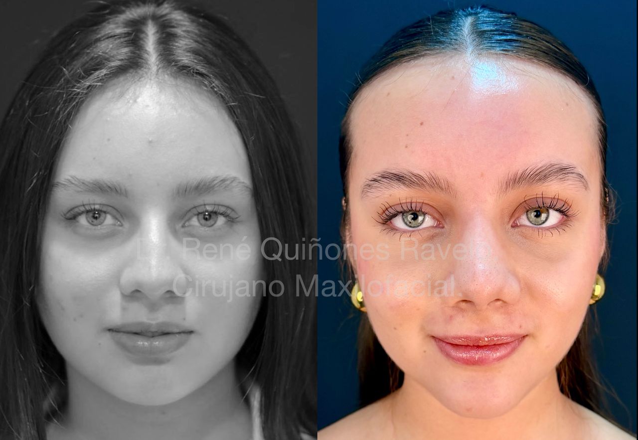 René Quiñones  Ravelo-8