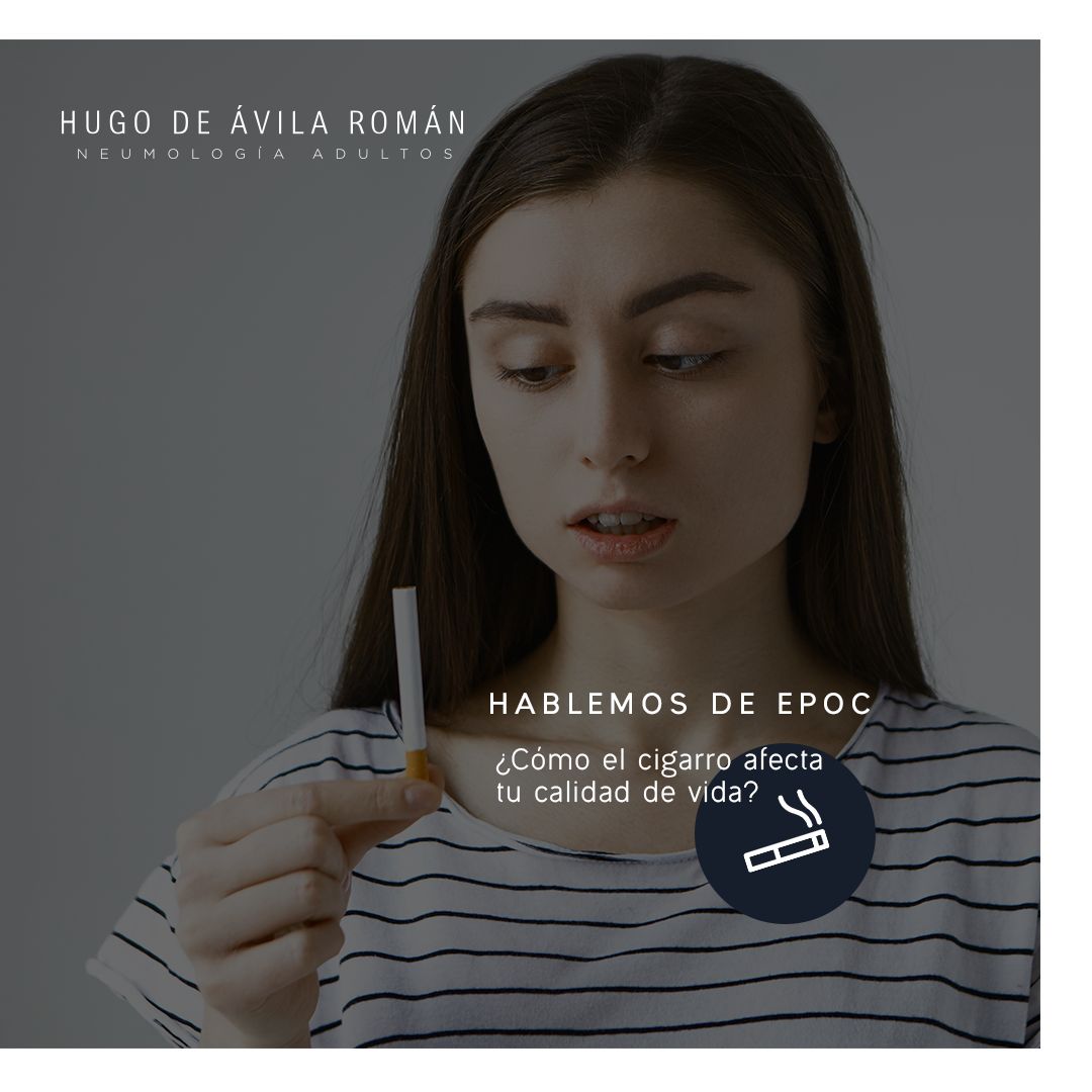 Hugo De Ávila Román-0