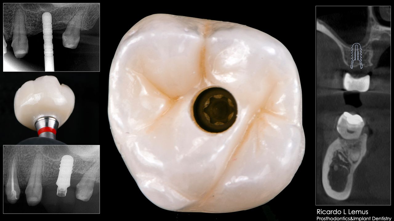 Ricardo López Lemus-22