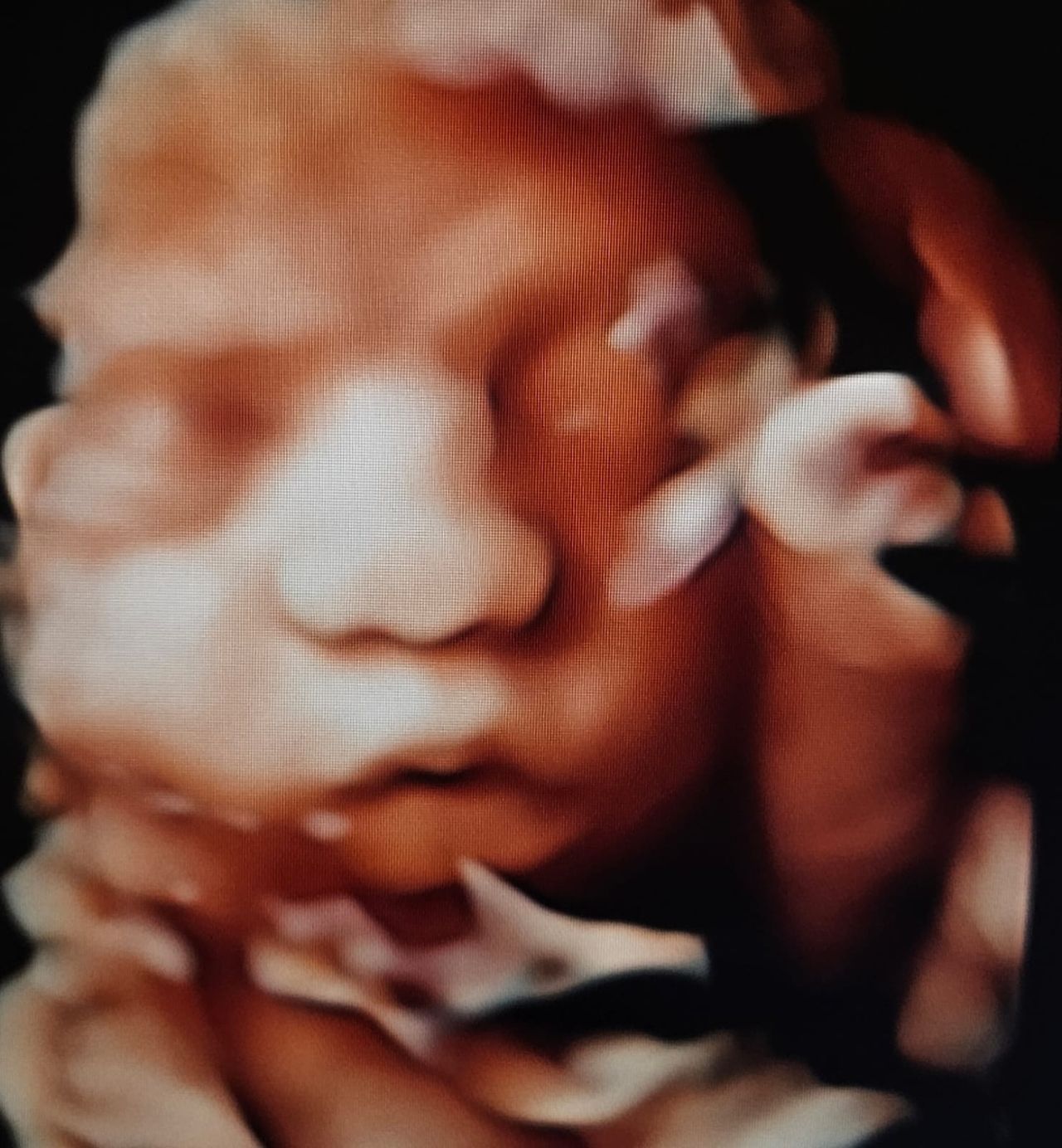 Luis Fernando Alvarez Valenzuela-2