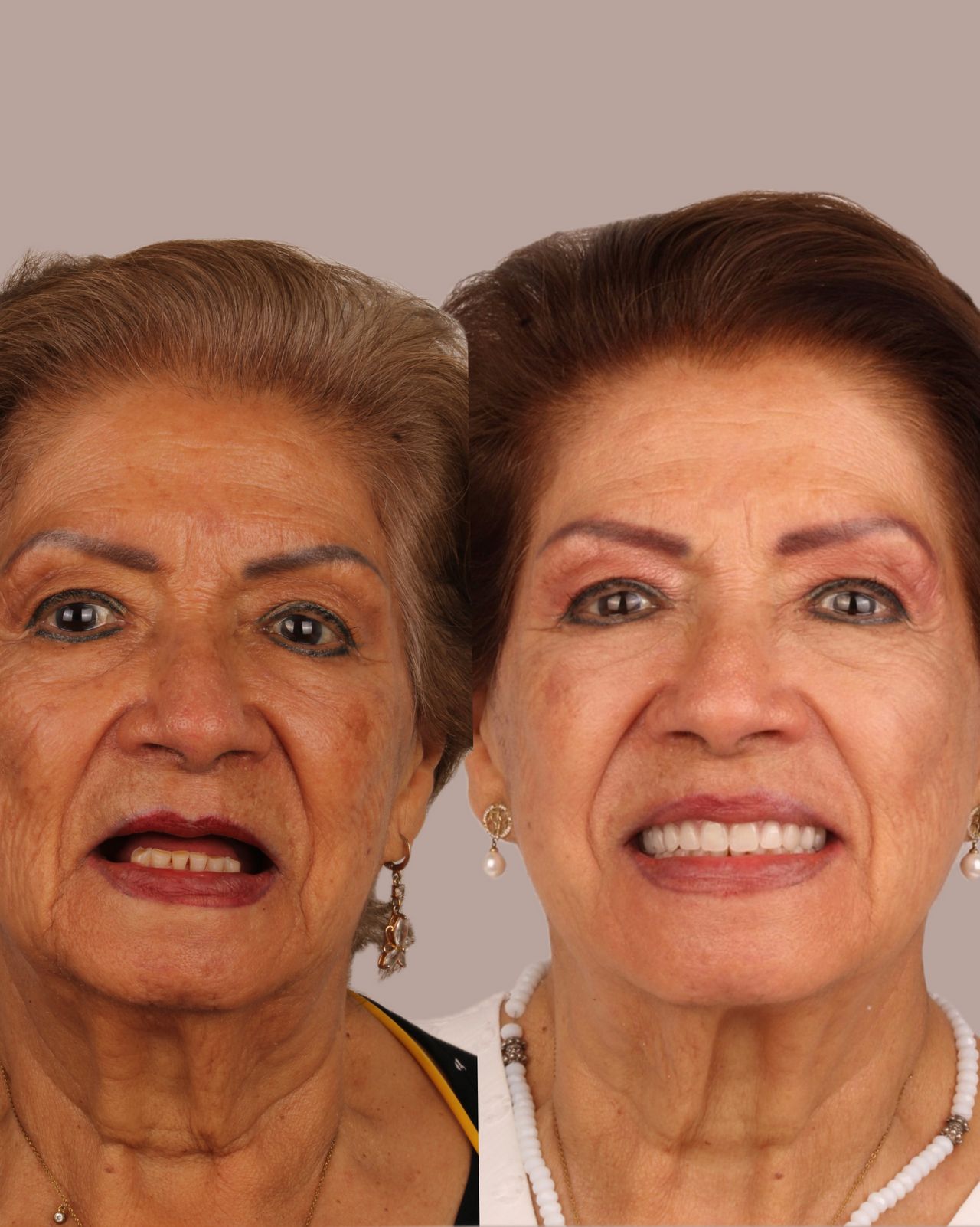 Miguel Alberto Escalona Mora-11