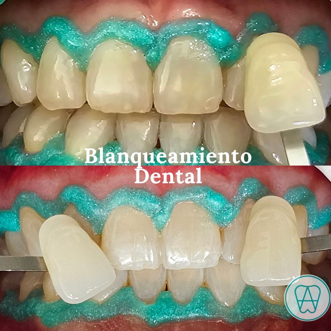 Alejandro Zamora Córdova-21