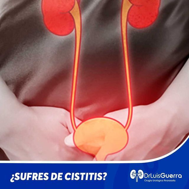 Luis Alberto Guerra Zepeda-180