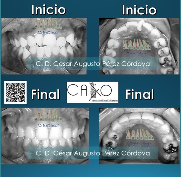 César Augusto Pérez Córdova-19