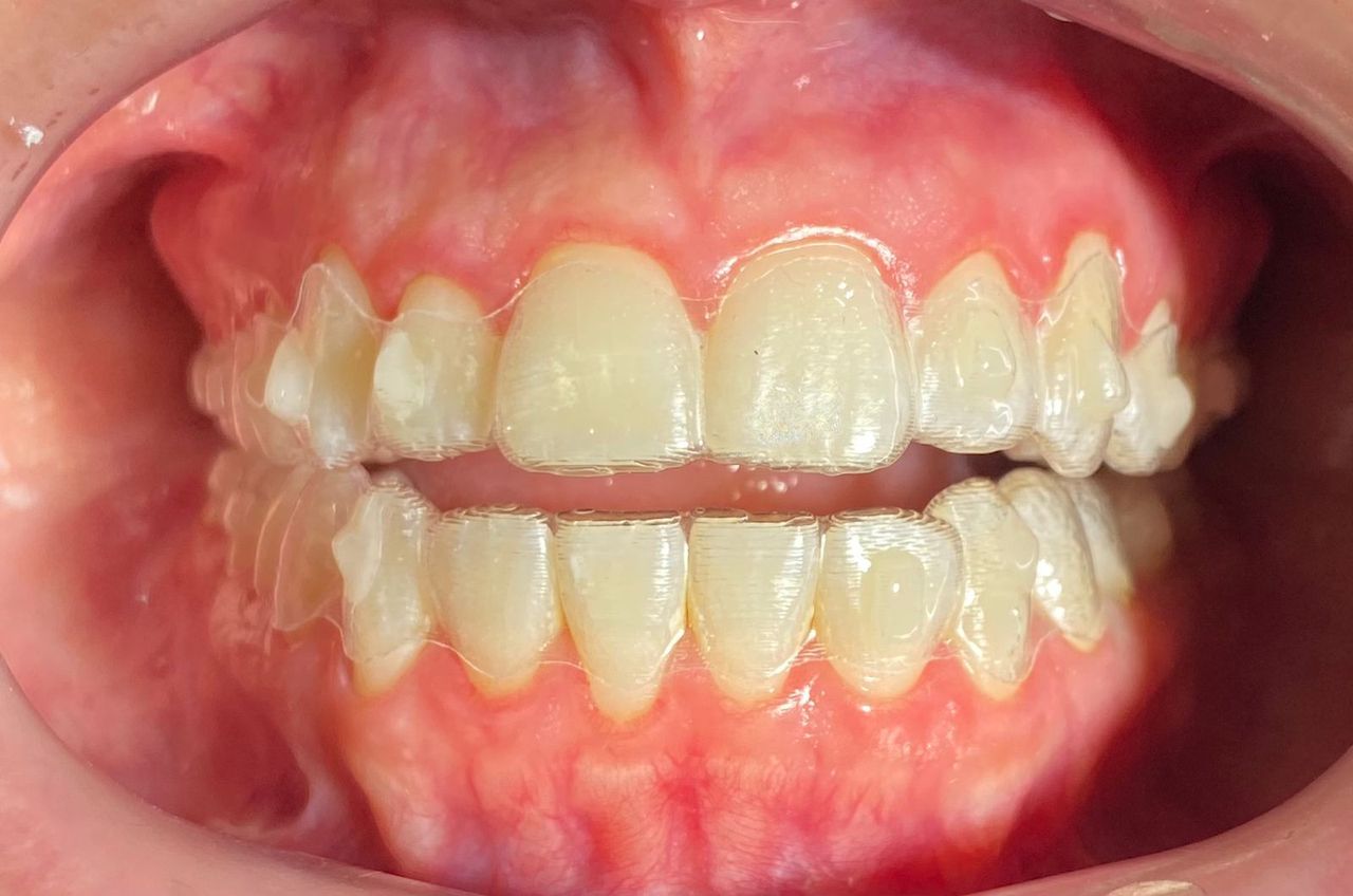 Melissa Díaz González Reyes-8