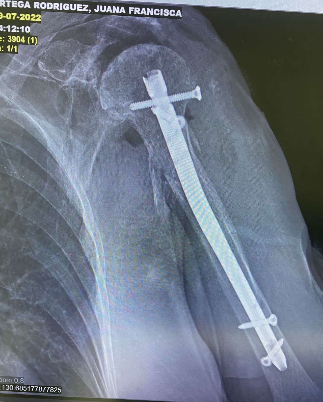 Oscar Alberto Pérez Peralta-30