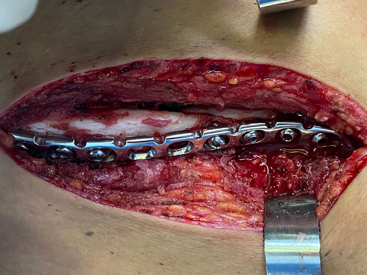 Alberto Lorenzo Cortés-11