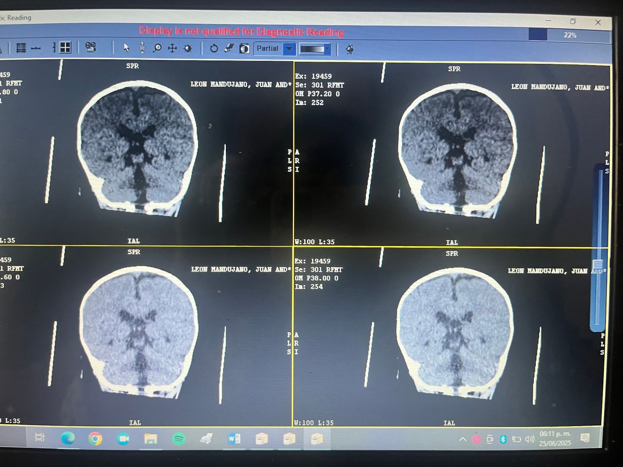 Miriam Emilia Reyes Martinez-25