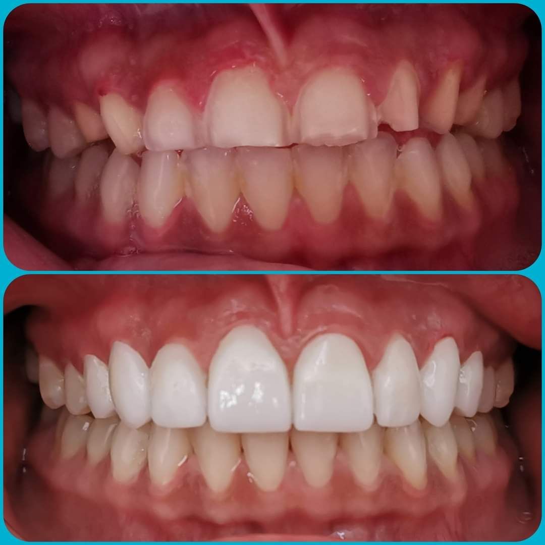 Ana Cecilia Chapa Kindling-23