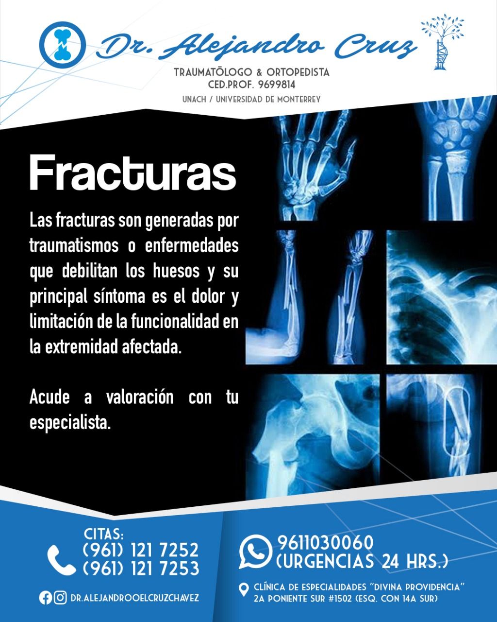 Alejandro Oel Cruz Chavez-11