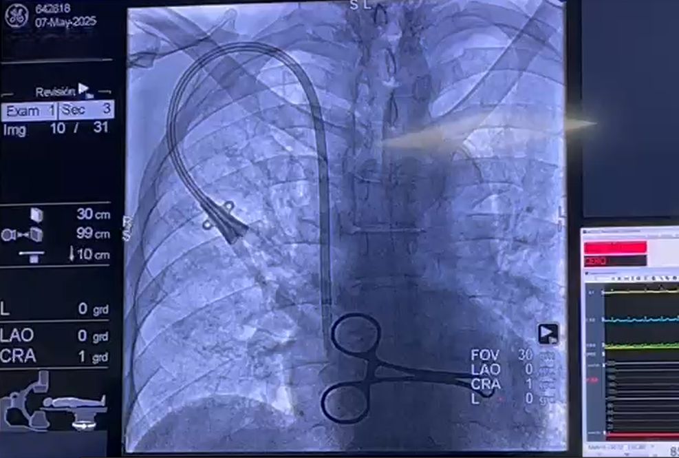 Guillermo Enrique Samayoa Peña-0