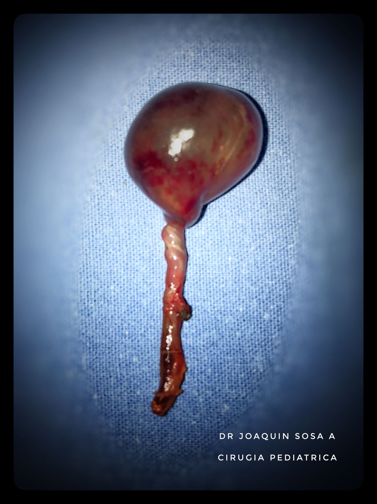 R. Joaquín Sosa Azcorra-39