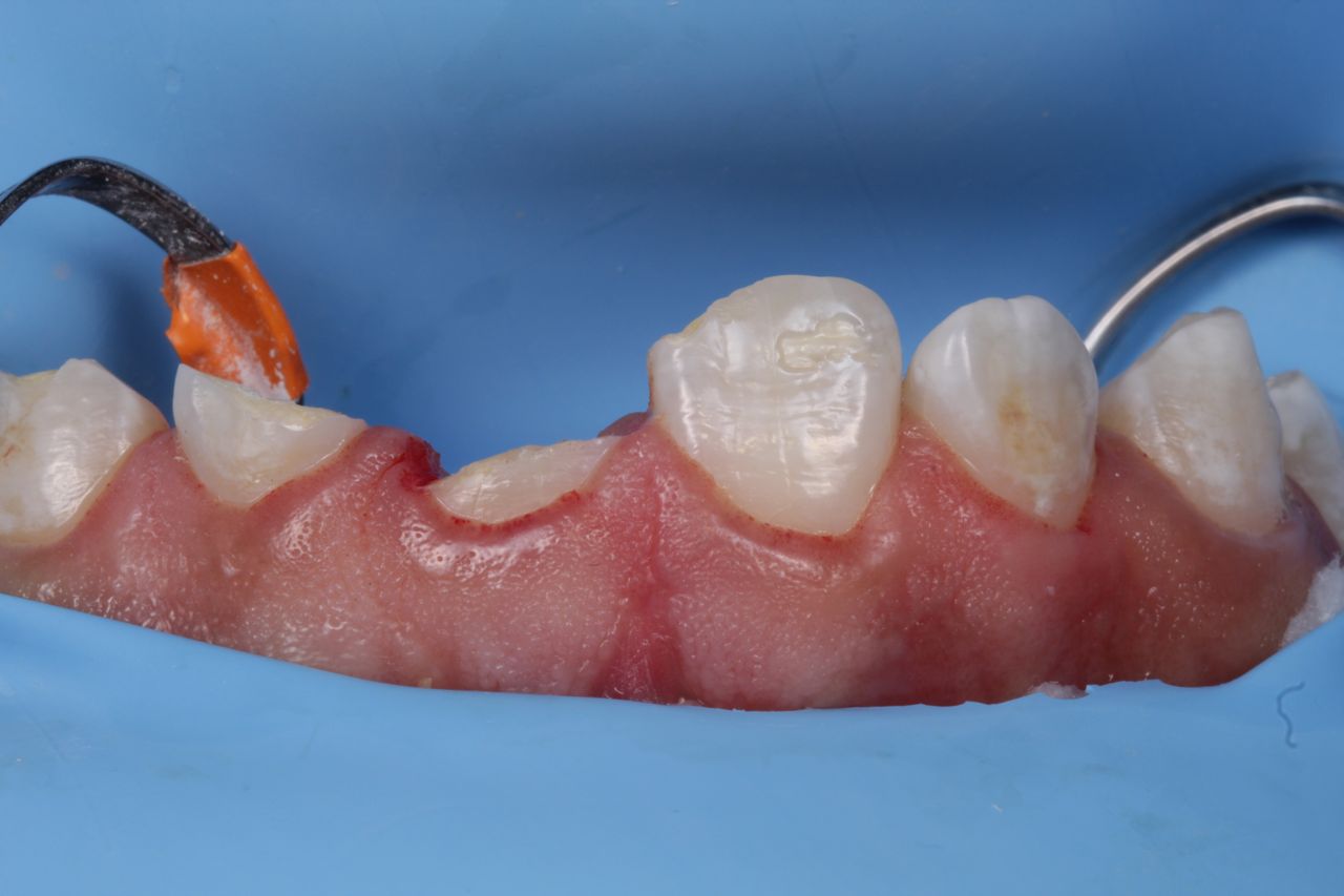 Fernando Fuentes Lozada-6