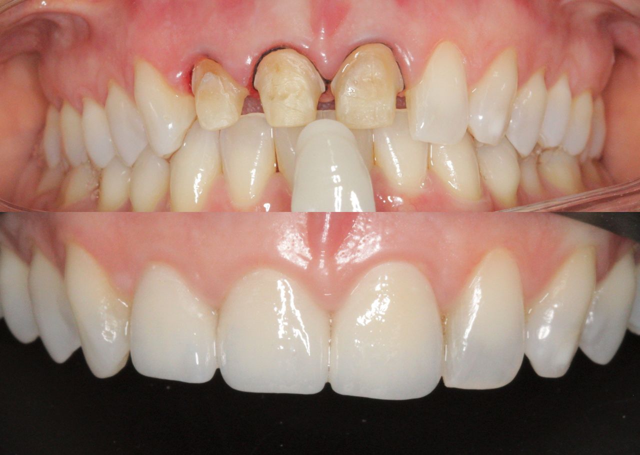 Adali Lopez Balderas-0