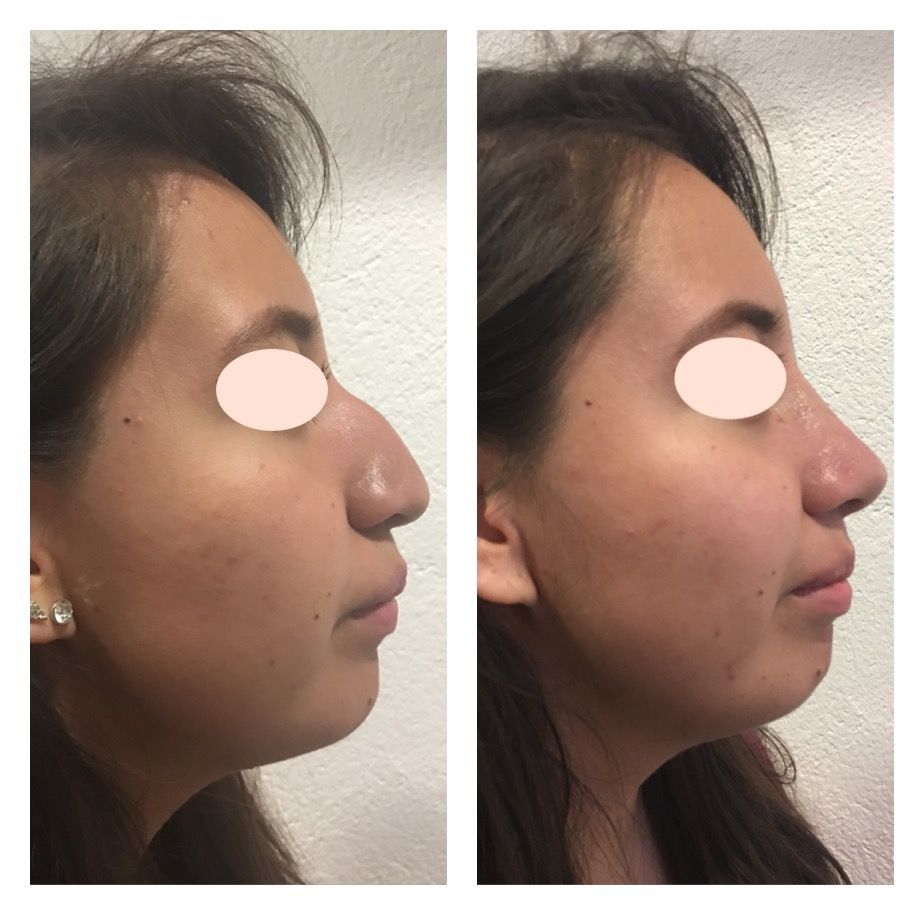 Carola Berenice Curiel Davalos-39