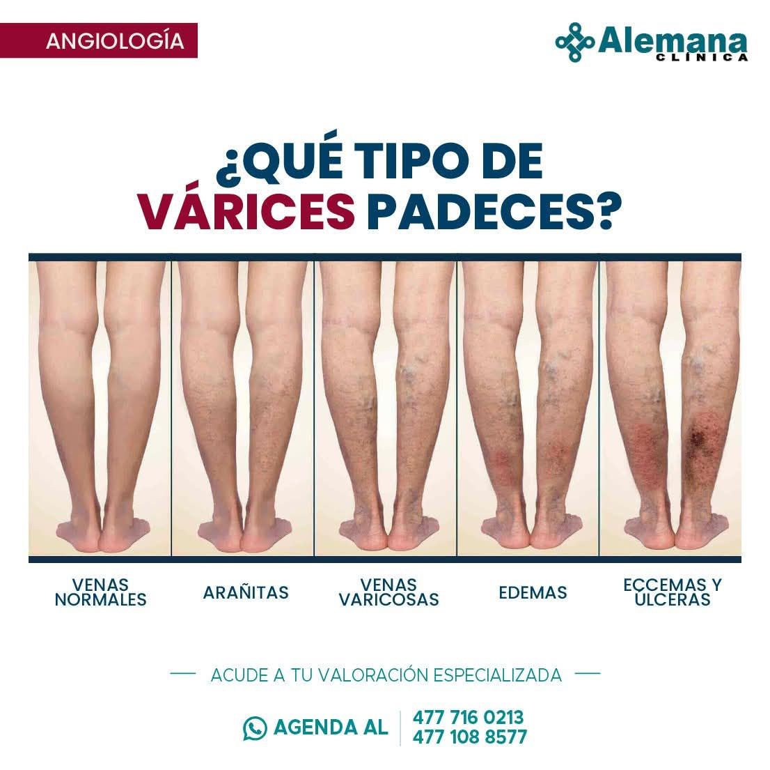 Anabel Salazar Reyes-24