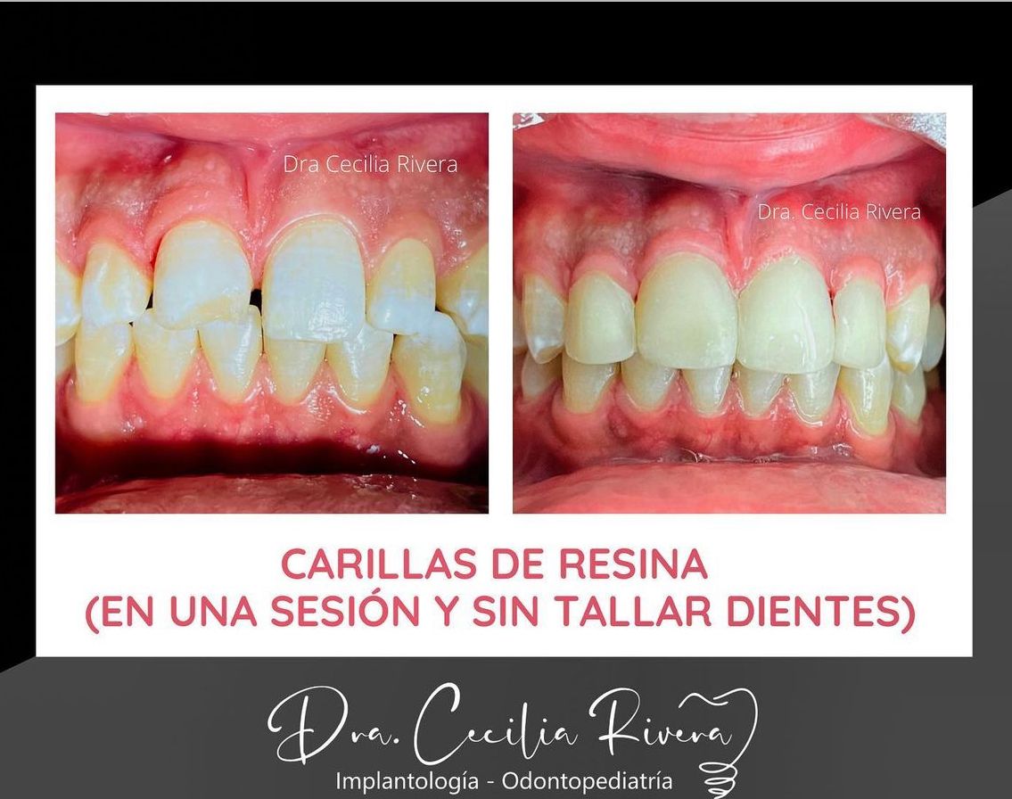 Cecilia Rivera Elizalde-25