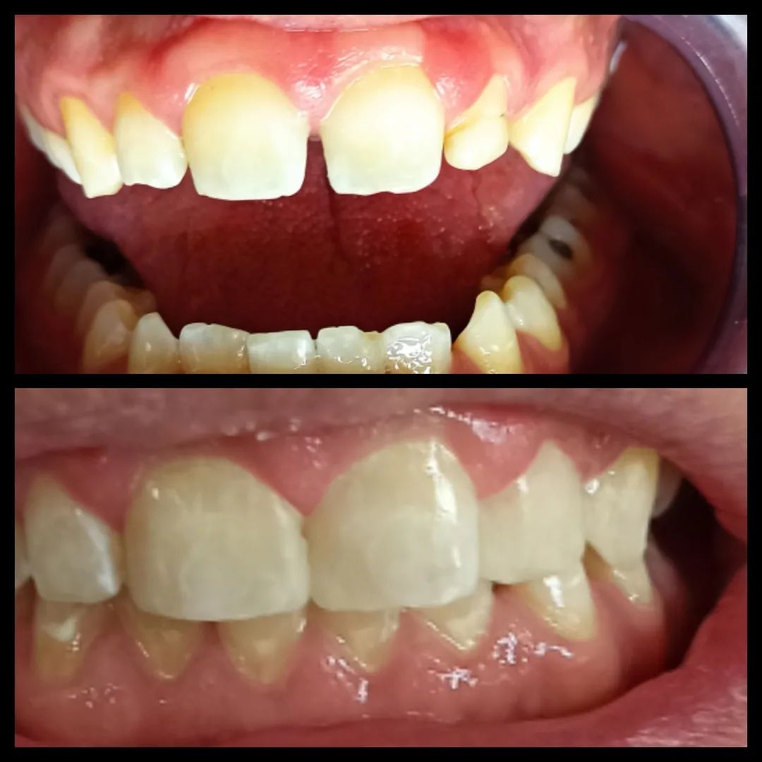 Oscar Cortez Perez-5