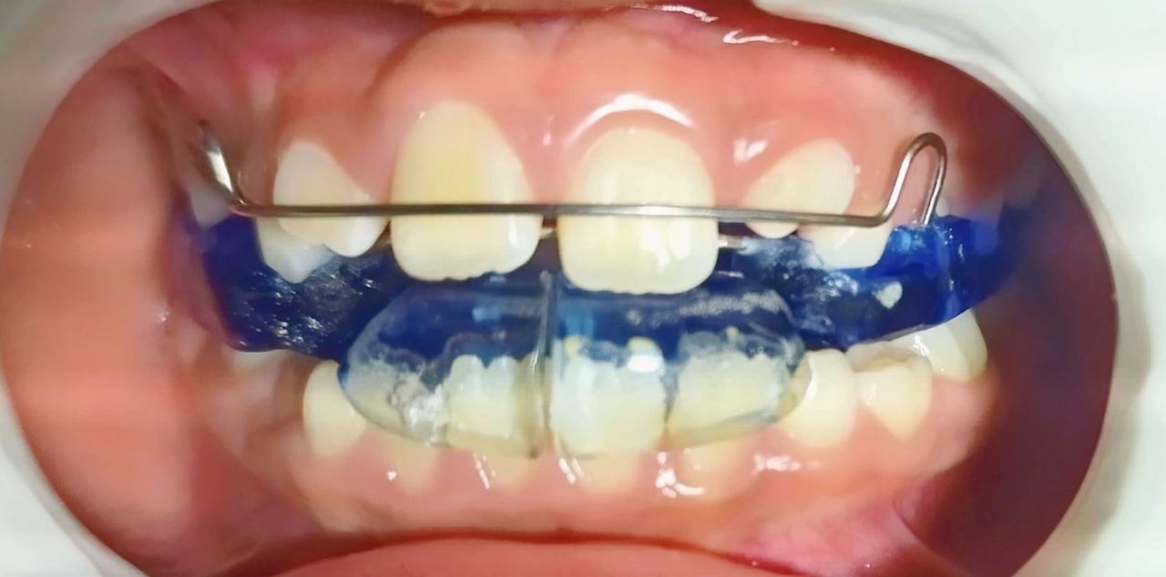 Cinthya Atzidy Feria Garay-19