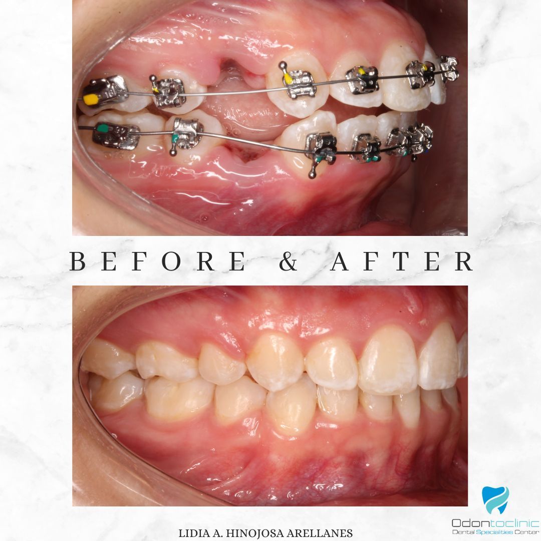 Lidia Abigail Hinojosa Arellanes-40