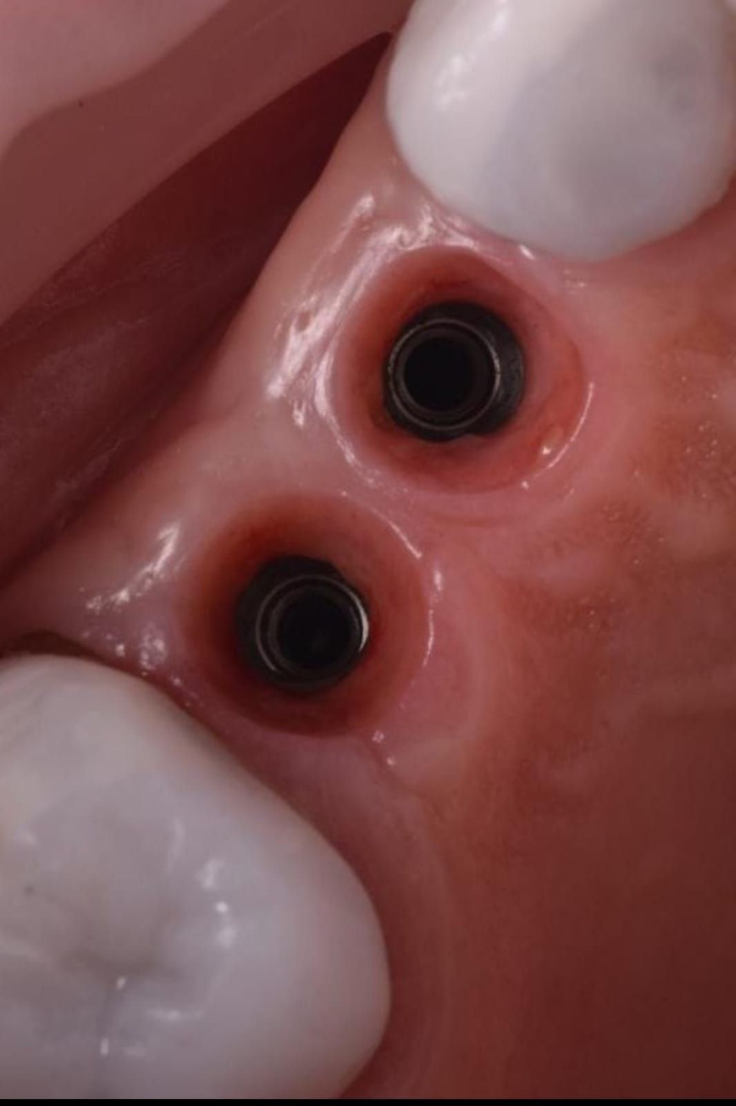 Carlos Ernesto Contreras Castellanos-16