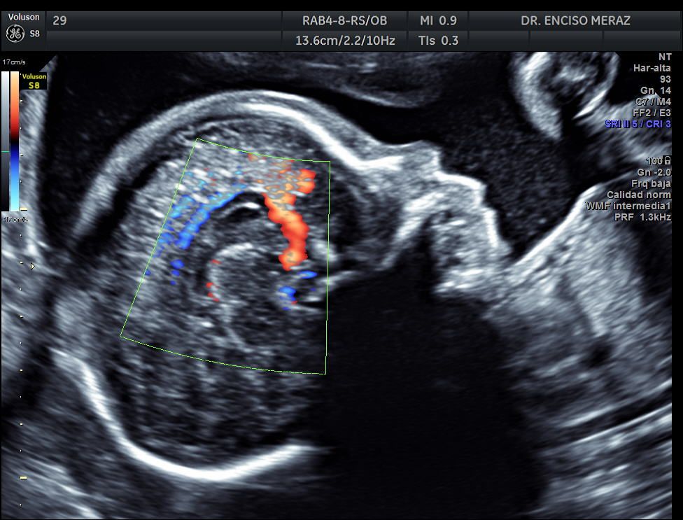 Juan Manuel Enciso Meraz-10