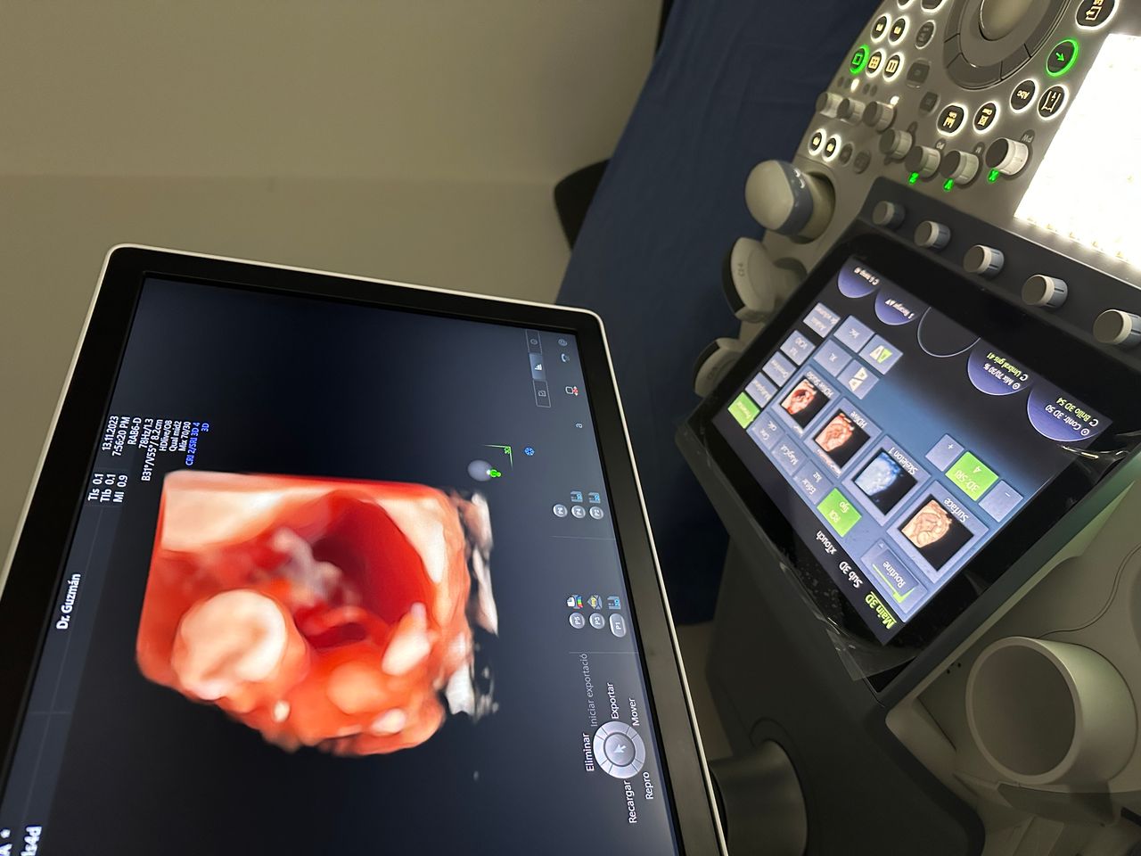 Eleazar I. Pérez Velázquez-6