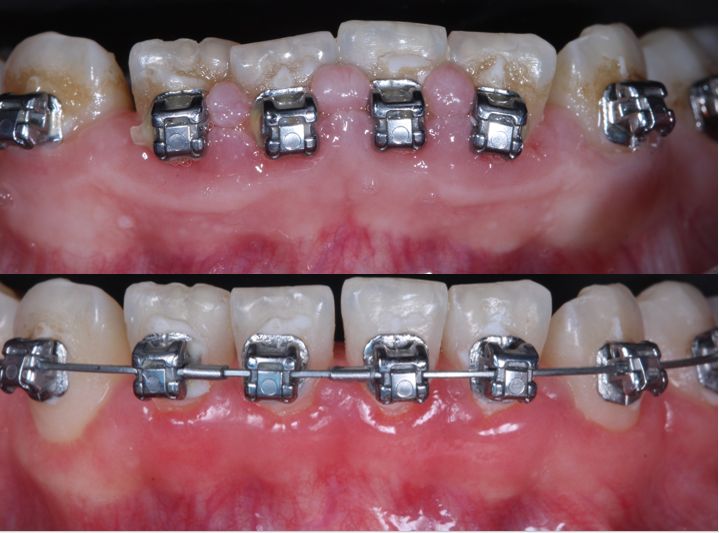 Ireri Rojas Bermúdez-22