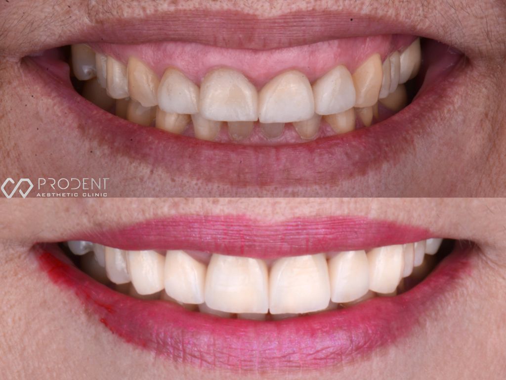 Ulises Pérez Murillo-70