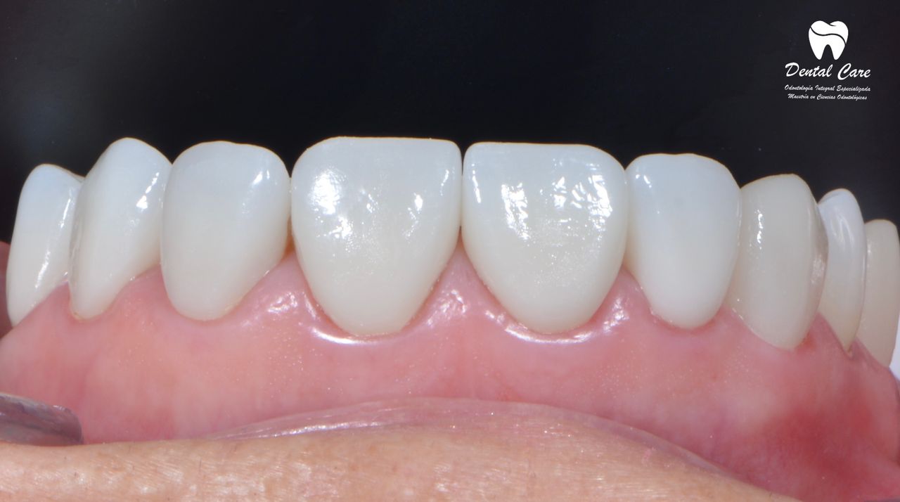 Carmen Angelica Gonzalez Osorio-0