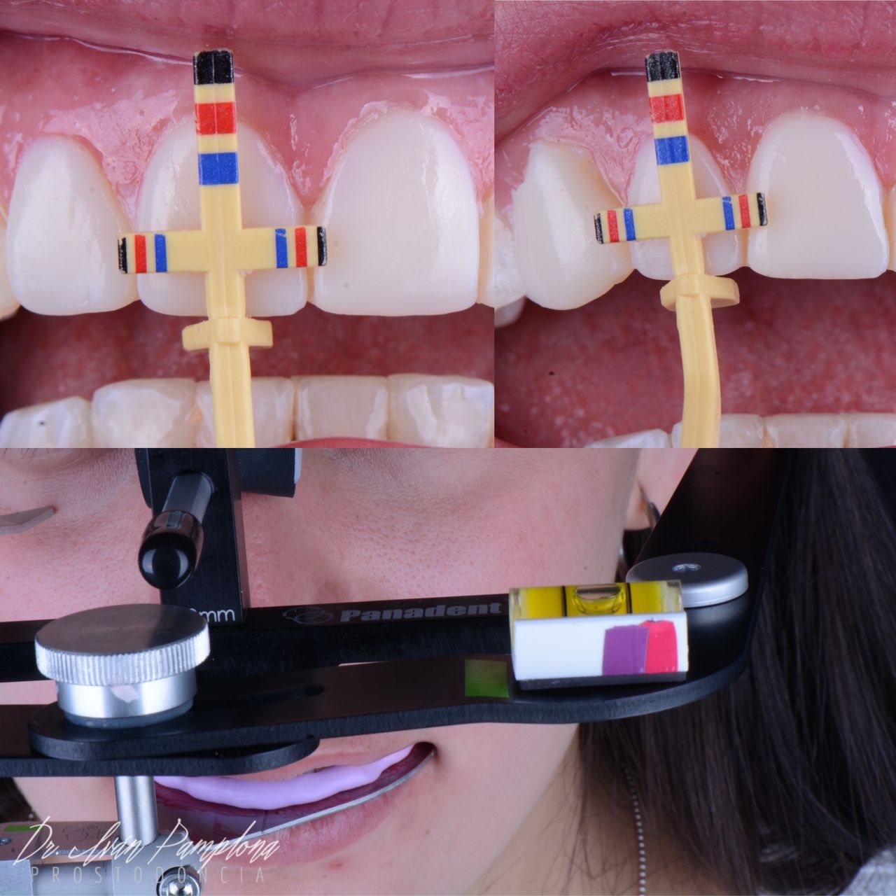 Iván Gerardo Pamplona Alfaro-7