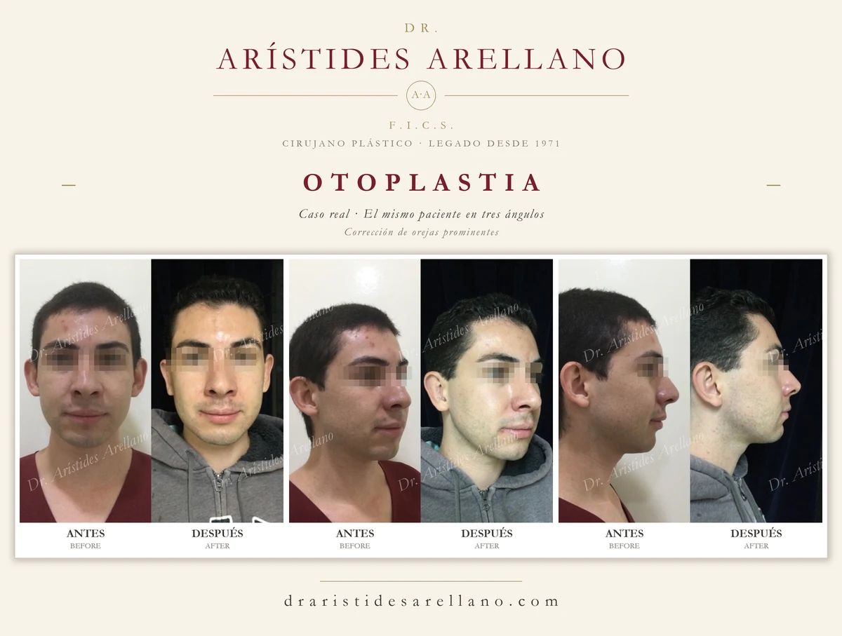 Arístides Arellano Huacuja-36