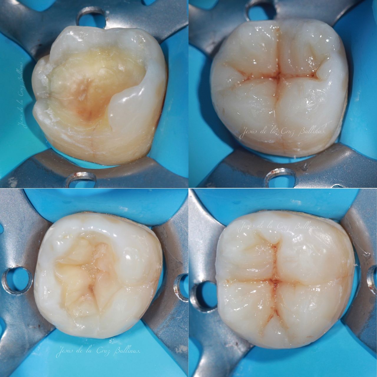 Jesus De La Cruz Ballinas-47