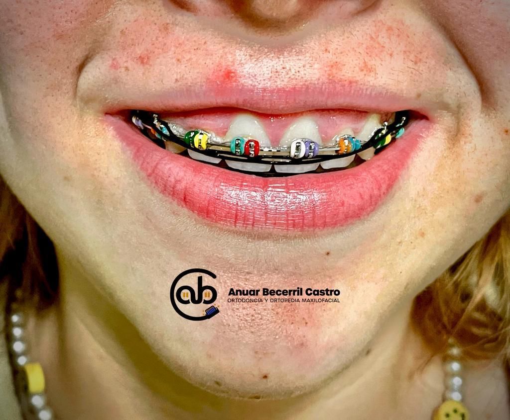 Anuar Becerril Castro-24