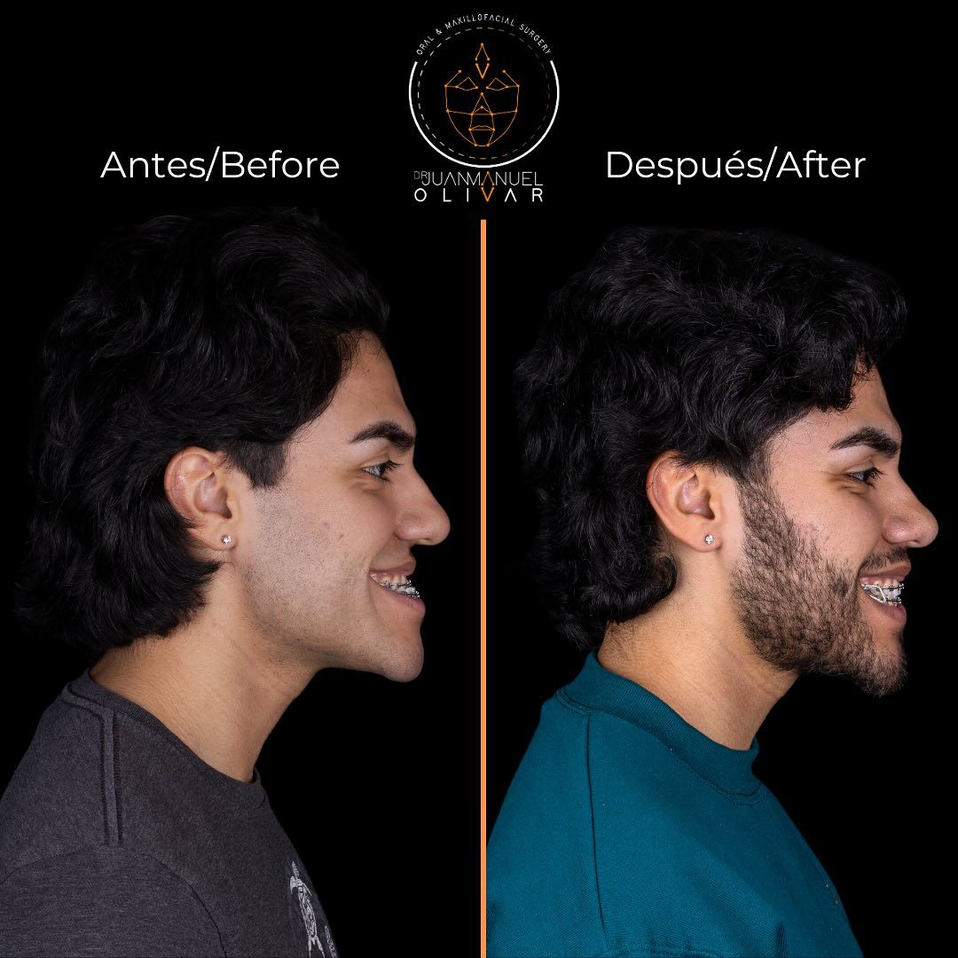 Juan Manuel Olivar Cedeño-3