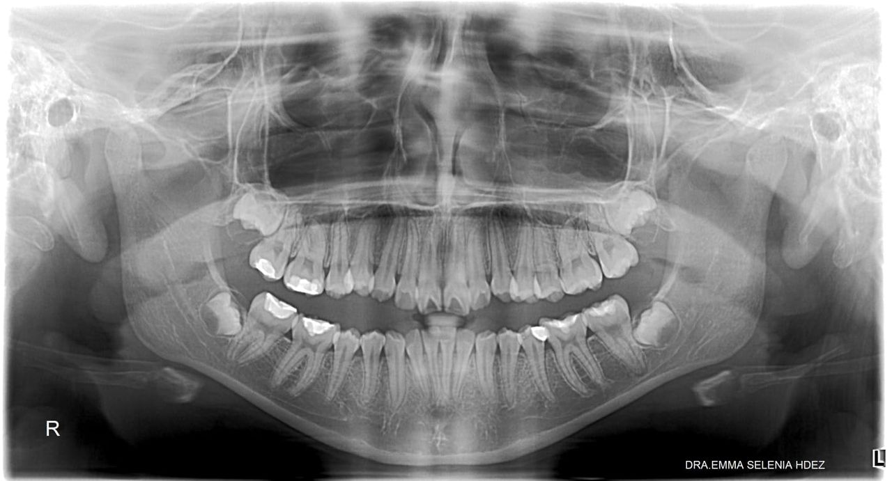 Emma Selenia Hernández Castillo-8